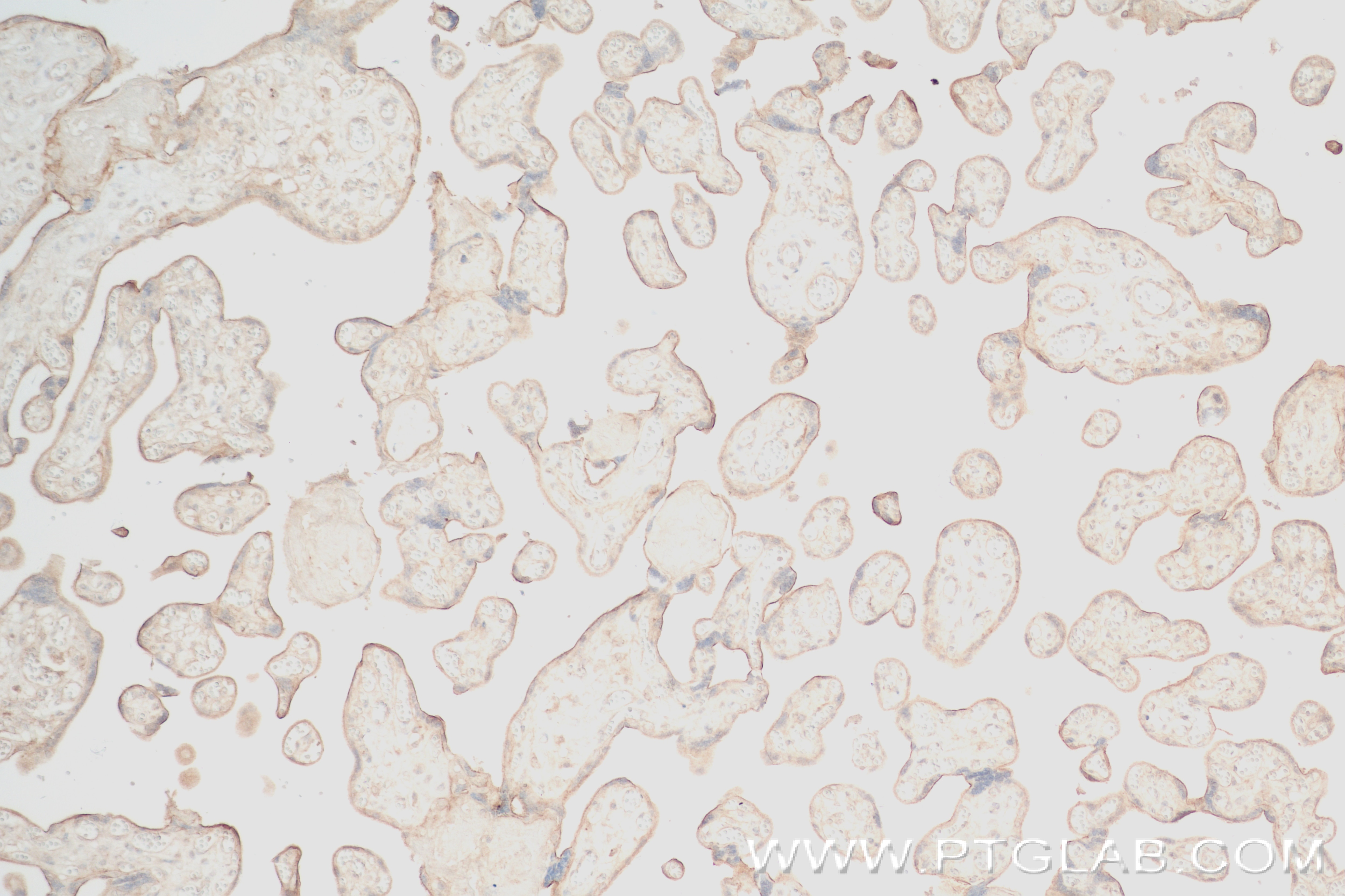Immunohistochemistry (IHC) staining of human placenta tissue using RPL3 Recombinant antibody (82815-1-RR)