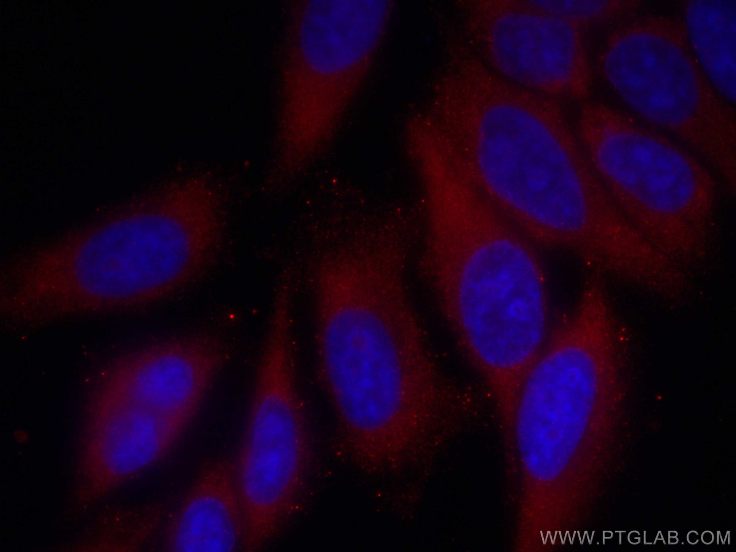 Immunofluorescence (IF) / fluorescent staining of HepG2 cells using CoraLite®594-conjugated RPL3 Monoclonal antibody (CL594-66130)