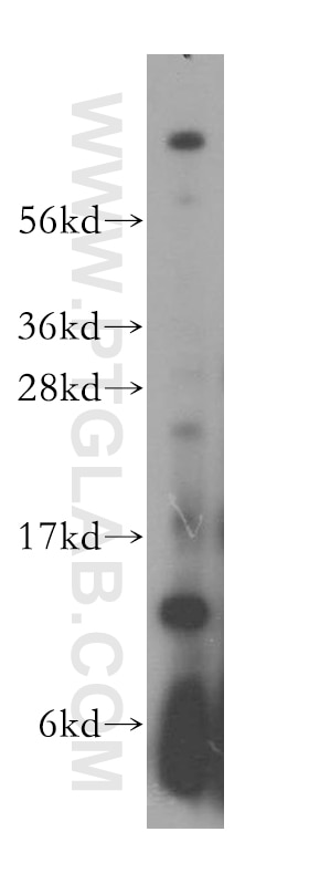 Western Blot (WB) analysis of HeLa cells using RPL30 Polyclonal antibody (17403-1-AP)