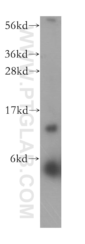 Western Blot (WB) analysis of SH-SY5Y cells using RPL30 Polyclonal antibody (17403-1-AP)