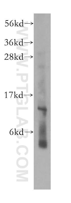 Western Blot (WB) analysis of A549 cells using RPL30 Polyclonal antibody (17403-1-AP)