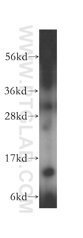 Western Blot (WB) analysis of HeLa cells using RPL30 Polyclonal antibody (17403-1-AP)