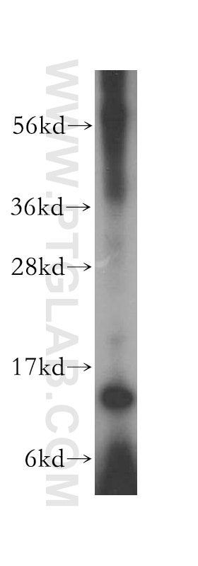 Western Blot (WB) analysis of MCF-7 cells using RPL30 Polyclonal antibody (17403-1-AP)