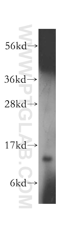 Western Blot (WB) analysis of Jurkat cells using RPL30 Polyclonal antibody (17403-1-AP)