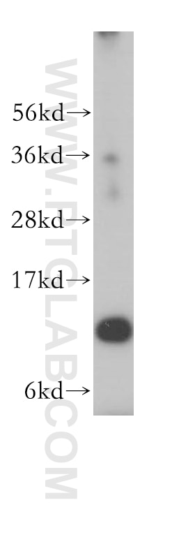 Western Blot (WB) analysis of A549 cells using RPL30 Polyclonal antibody (17403-1-AP)