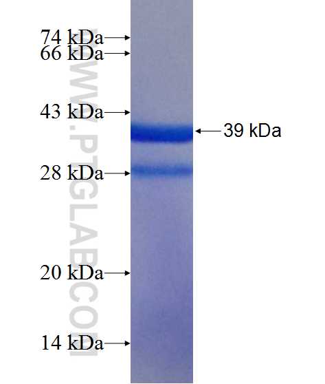 RPL30 fusion protein Ag11381 SDS-PAGE