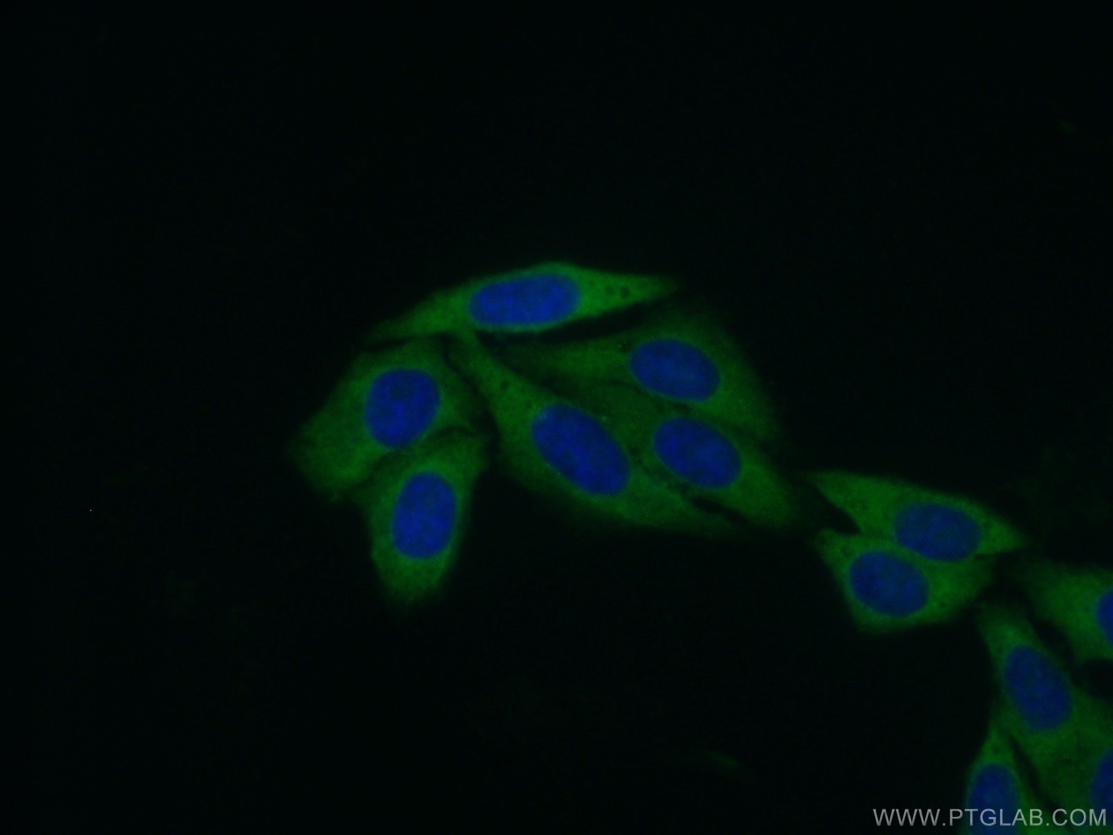 Immunofluorescence (IF) / fluorescent staining of HepG2 cells using RPL31 Polyclonal antibody (16497-1-AP)