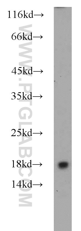 Western Blot (WB) analysis of NIH/3T3 cells using RPL31 Polyclonal antibody (16497-1-AP)