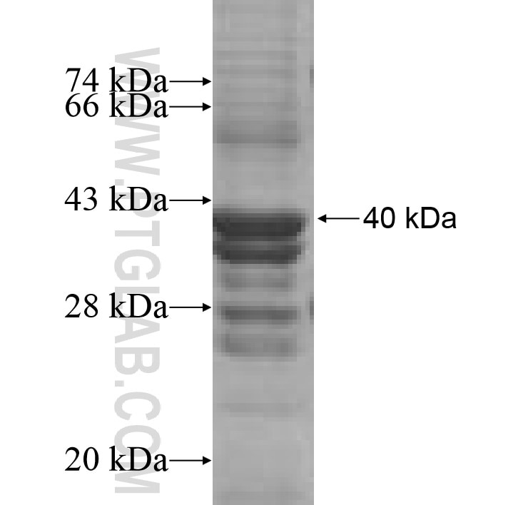 RPL31 fusion protein Ag9611 SDS-PAGE