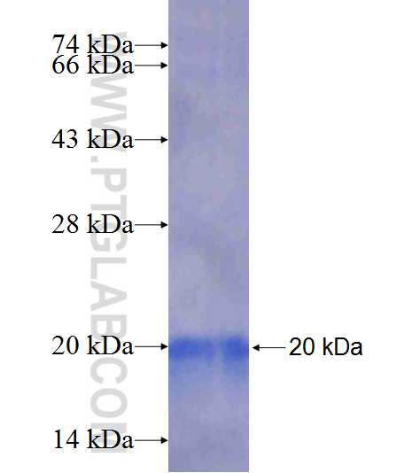 RPL31 fusion protein Ag9648 SDS-PAGE