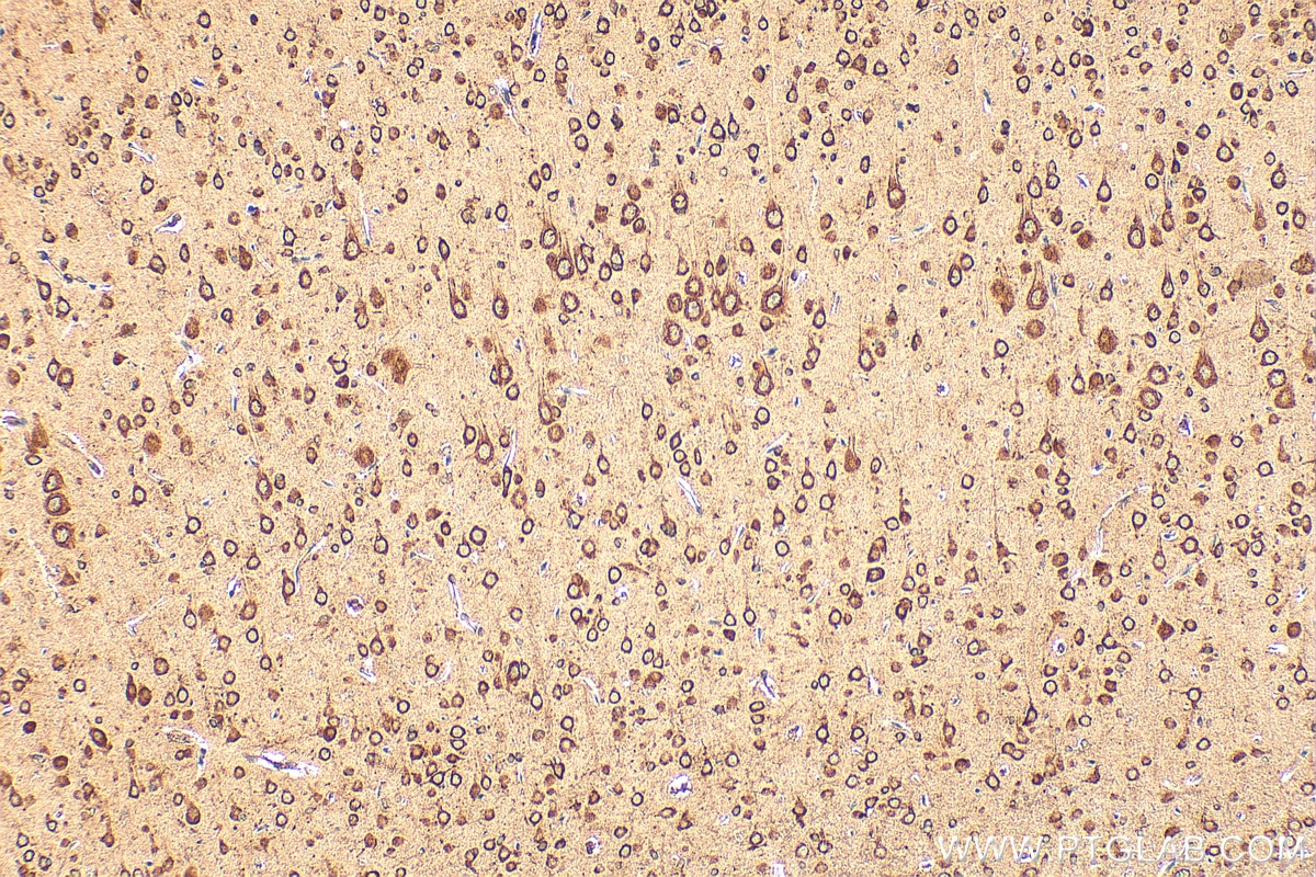 Immunohistochemistry (IHC) staining of rat brain tissue using RPL32 Polyclonal antibody (16629-1-AP)