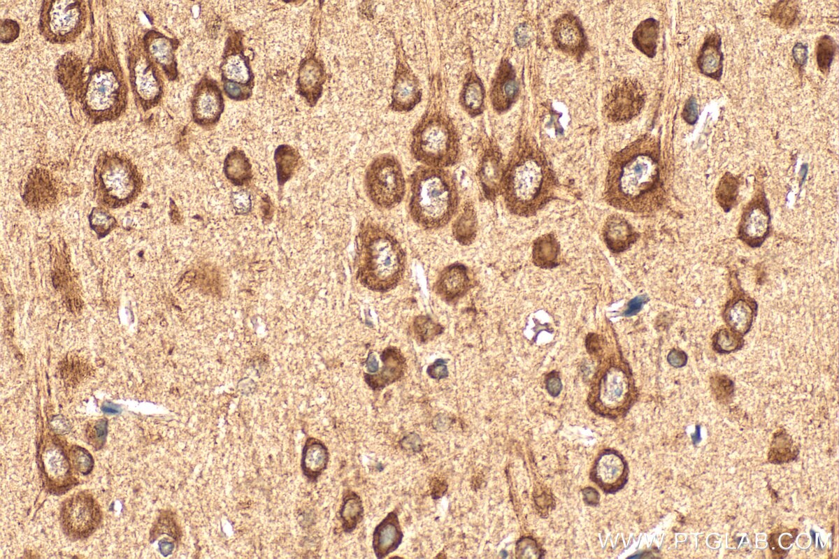 Immunohistochemistry (IHC) staining of rat brain tissue using RPL32 Polyclonal antibody (16629-1-AP)