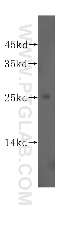 Western Blot (WB) analysis of HeLa cells using RPL32 Polyclonal antibody (16629-1-AP)