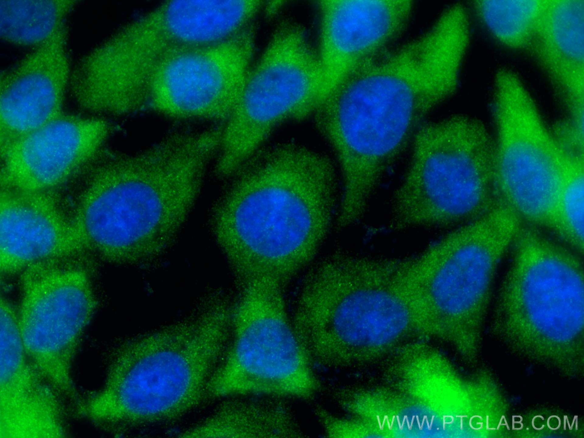 Immunofluorescence (IF) / fluorescent staining of A431 cells using RPL34 Polyclonal antibody (15179-1-AP)