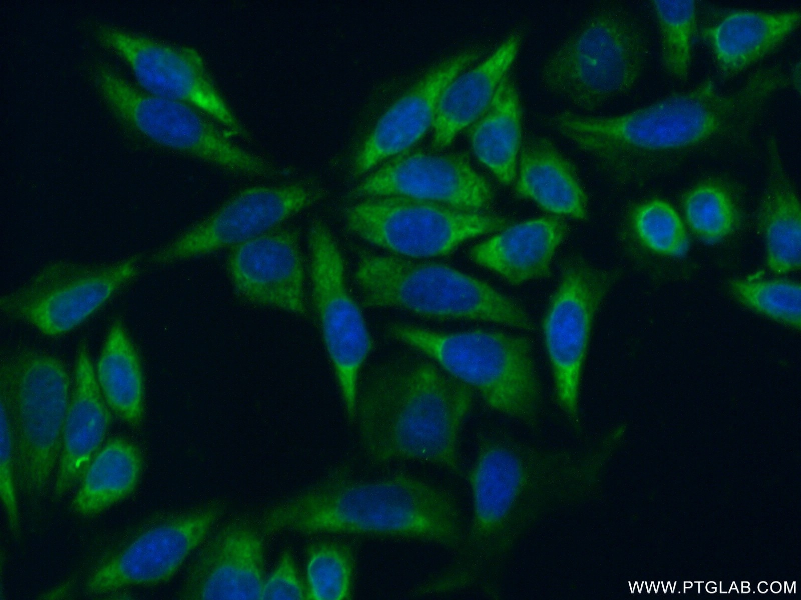 Immunofluorescence (IF) / fluorescent staining of HeLa cells using RPL35 Polyclonal antibody (14826-1-AP)