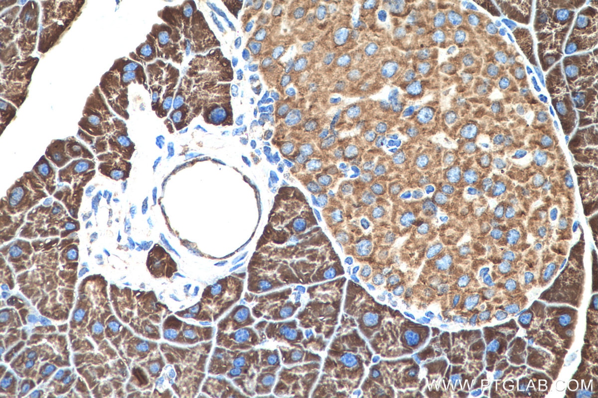 IHC staining of mouse pancreas using 14826-1-AP