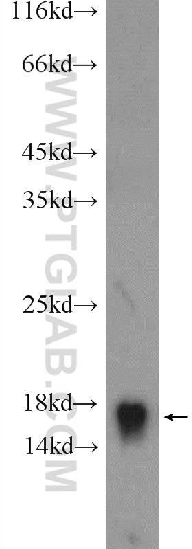 Western Blot (WB) analysis of HeLa cells using RPL35 Polyclonal antibody (14826-1-AP)