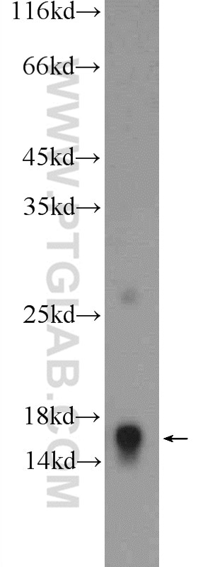 Western Blot (WB) analysis of HeLa cells using RPL35 Polyclonal antibody (14826-1-AP)