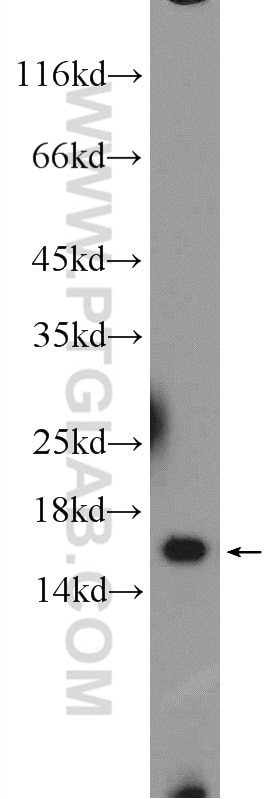 WB analysis of mouse heart using 14826-1-AP