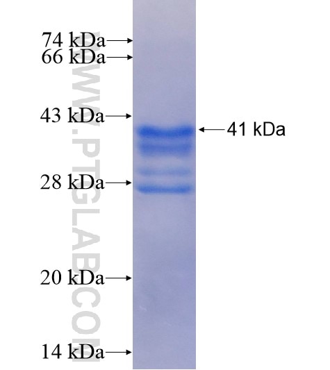 RPL35 fusion protein Ag6615 SDS-PAGE