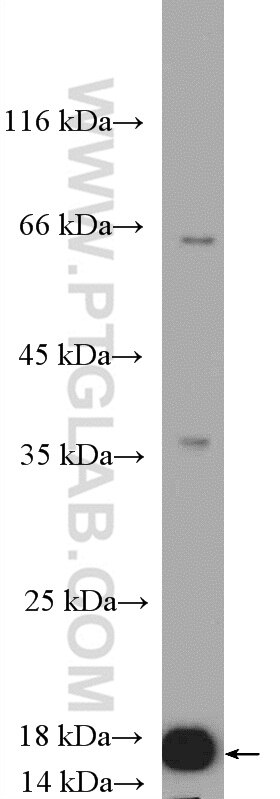 Western Blot (WB) analysis of HeLa cells using RPL36 Polyclonal antibody (15145-1-AP)