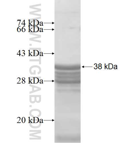 RPL36AL fusion protein Ag7853 SDS-PAGE
