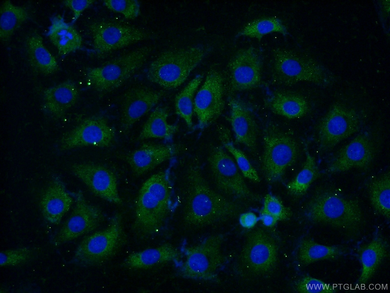 Immunofluorescence (IF) / fluorescent staining of SH-SY5Y cells using RPL37A Polyclonal antibody (14660-1-AP)
