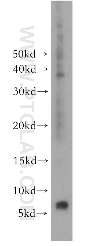 Western Blot (WB) analysis of HeLa cells using RPL38 Polyclonal antibody (15055-1-AP)