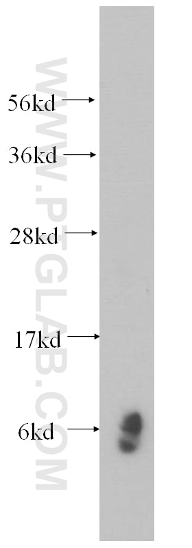 Western Blot (WB) analysis of human liver tissue using RPL39 Polyclonal antibody (14990-1-AP)