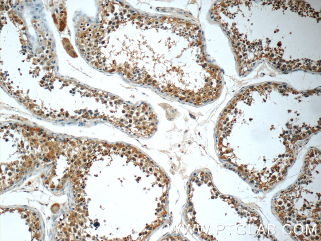 Immunohistochemistry (IHC) staining of human testis tissue using RPL39L Polyclonal antibody (24940-1-AP)