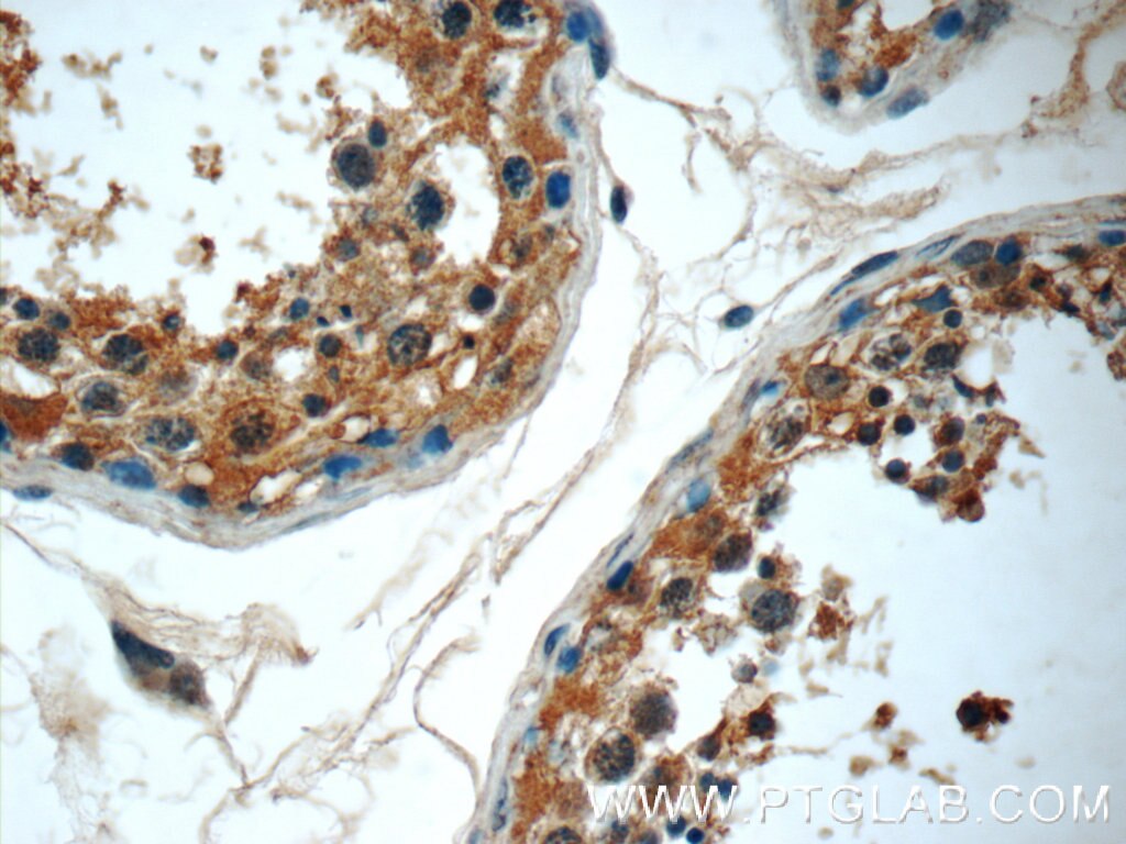 Immunohistochemistry (IHC) staining of human testis tissue using RPL39L Polyclonal antibody (24940-1-AP)