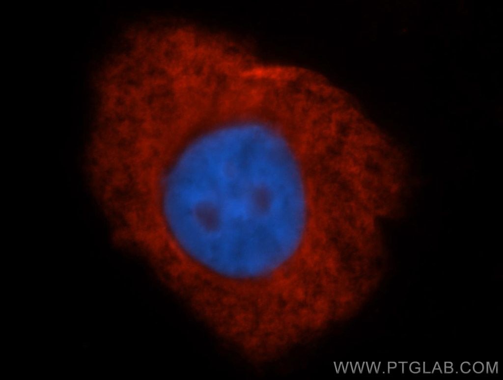 Immunofluorescence (IF) / fluorescent staining of HepG2 cells using Ribosomal protein L4 Polyclonal antibody (11302-1-AP)