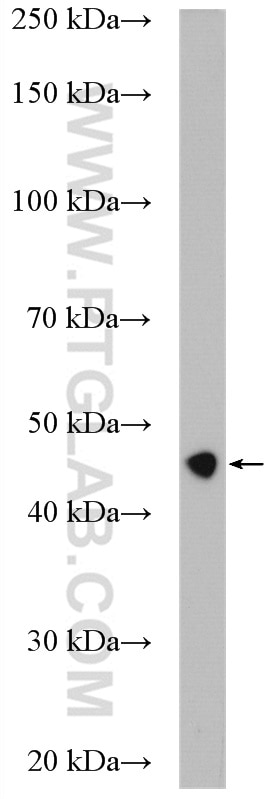 Western Blot (WB) analysis of rat skeletal muscle tissue using Ribosomal protein L4 Polyclonal antibody (11302-1-AP)