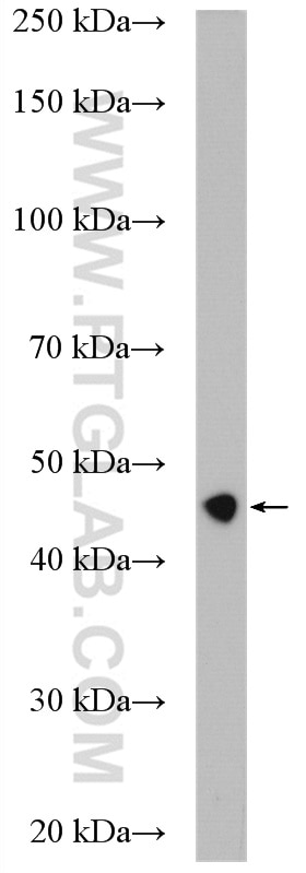 WB analysis of rat skeletal muscle using 11302-1-AP