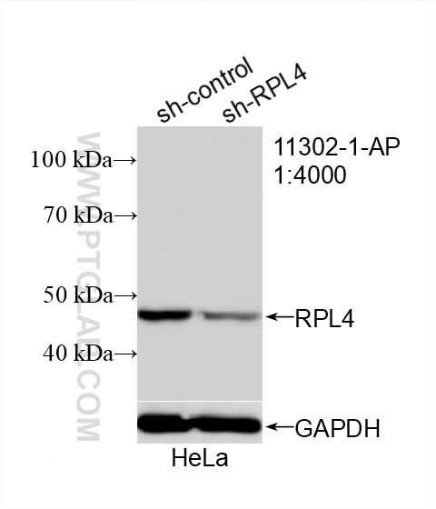 Western Blot (WB) analysis of HeLa cells using Ribosomal protein L4 Polyclonal antibody (11302-1-AP)