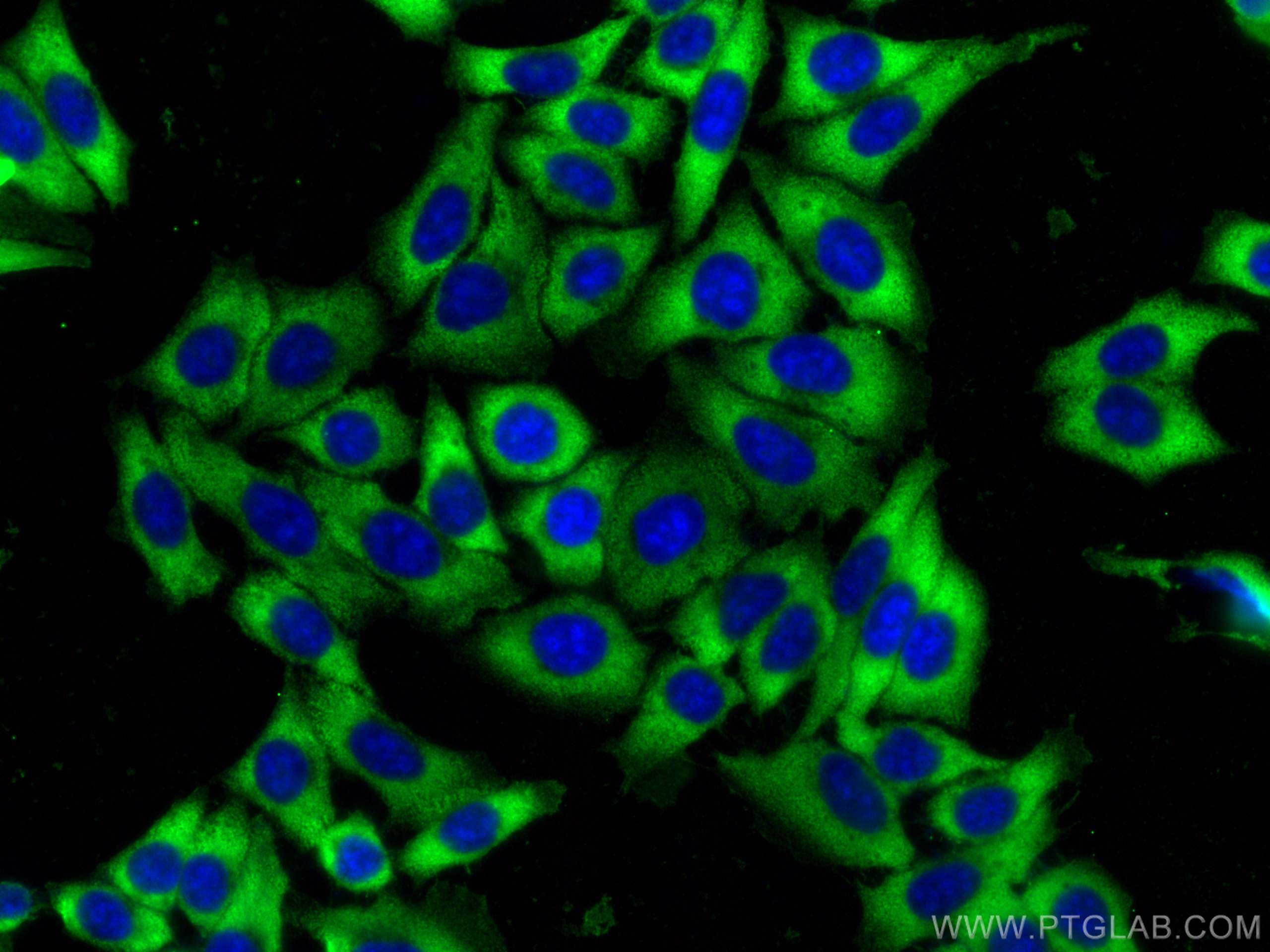 Immunofluorescence (IF) / fluorescent staining of HepG2 cells using Ribosomal protein L4 Monoclonal antibody (67028-1-Ig)