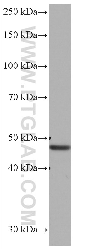 Western Blot (WB) analysis of HeLa cells using Ribosomal protein L4 Monoclonal antibody (67028-1-Ig)