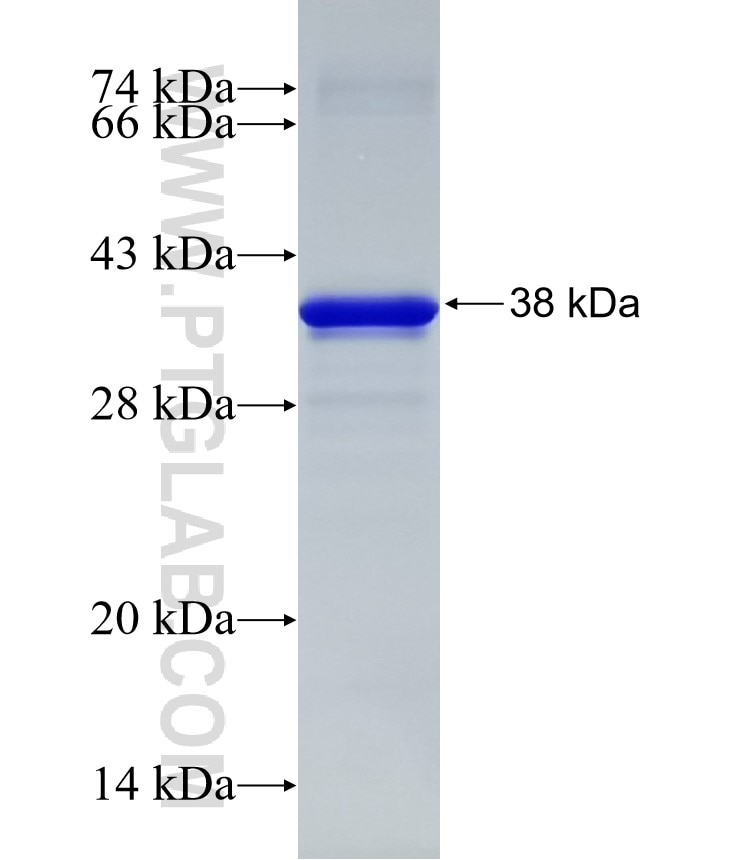 RPL4 fusion protein Ag32271 SDS-PAGE RPL4 fusion protein Ag32271 SDS-PAGE