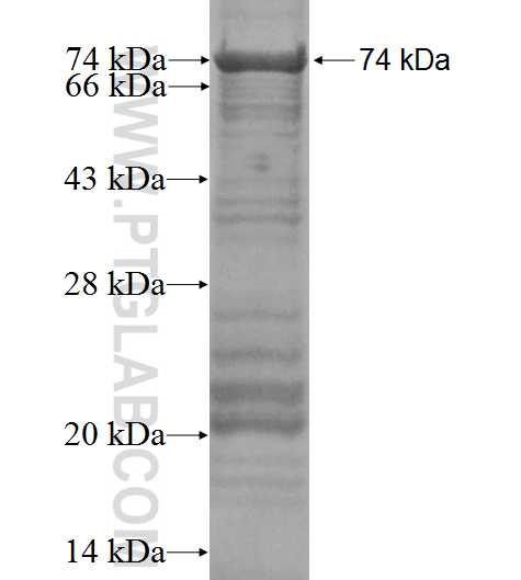 RPL4 fusion protein Ag1828 SDS-PAGE