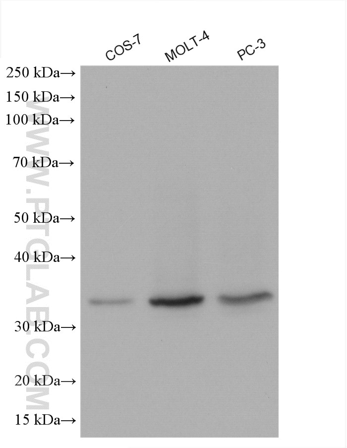 Western Blot (WB) analysis of various lysates using RPL5 Polyclonal antibody (29092-1-AP)