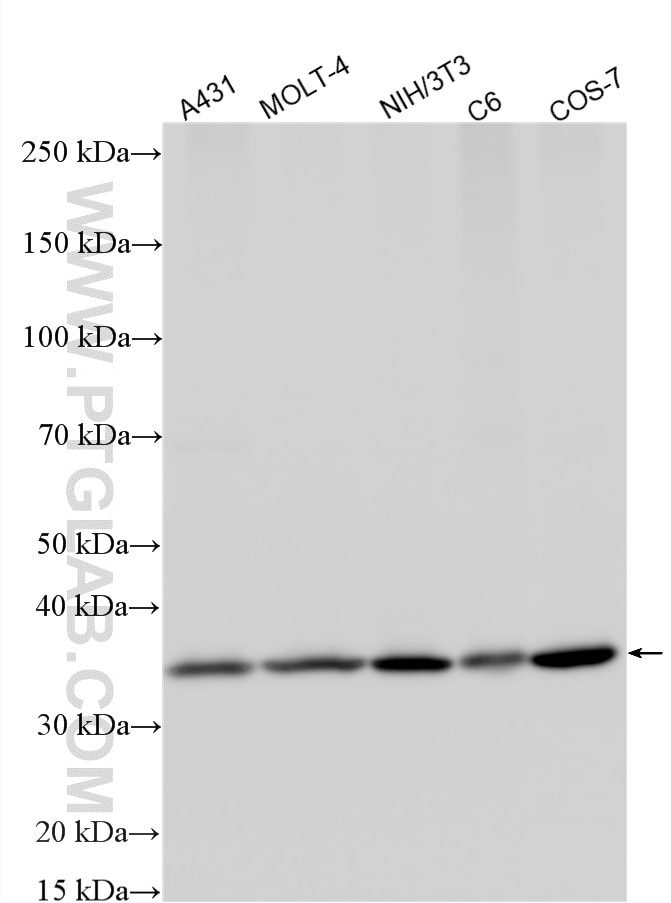 Various lysates were subjected to SDS PAGE followed by western blot with 29092-1-AP (RPL5 antibody) at dilution of 1:4000 incubated at room temperature for 1.5 hours. Western Blot (WB) analysis of various lysates using RPL5 Polyclonal antibody (29092-1-AP)
