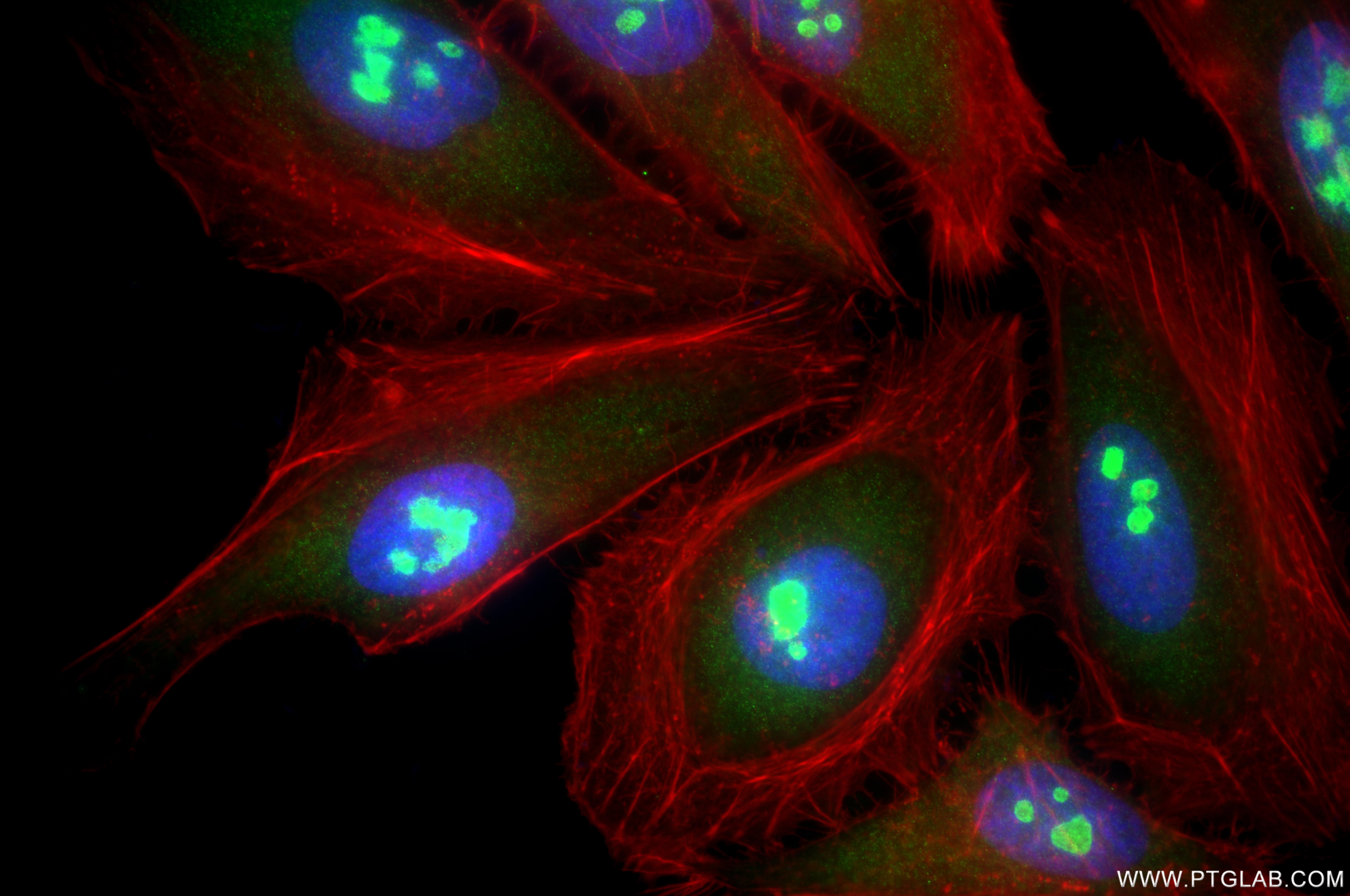 Immunofluorescence (IF) / fluorescent staining of HeLa cells using RPL5 Recombinant monoclonal antibody (85348-1-RR)