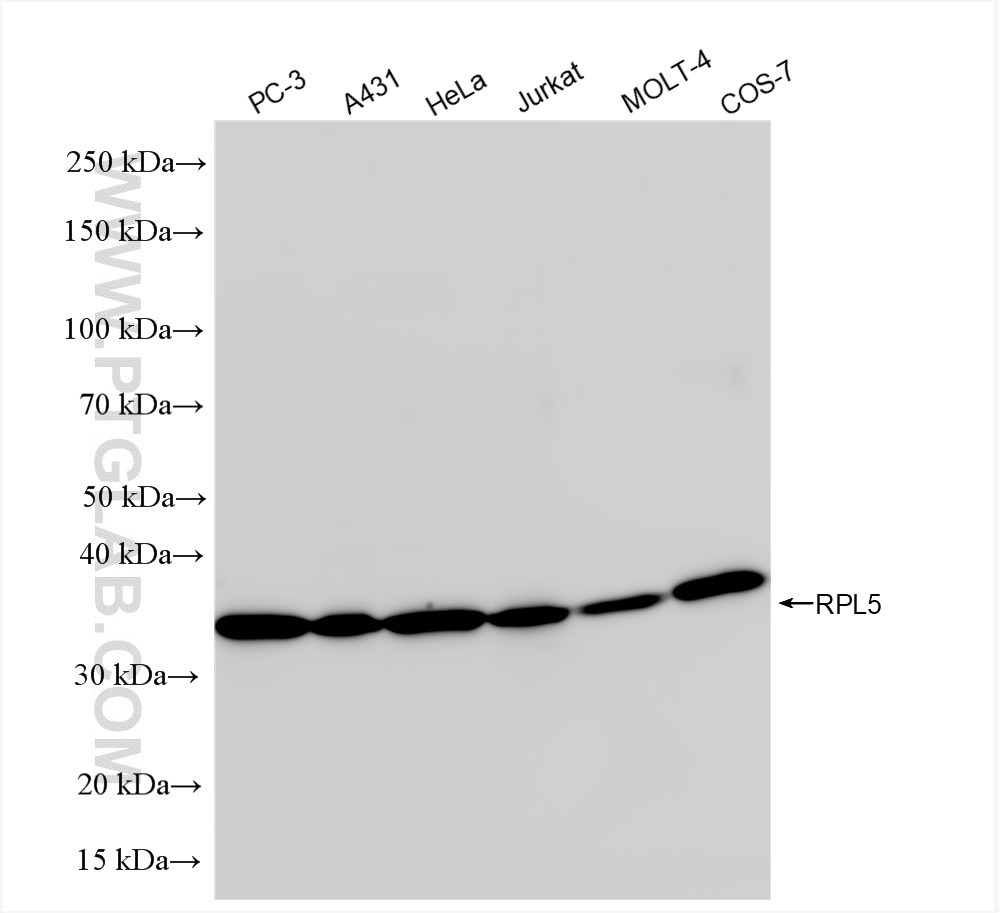 Western Blot (WB) analysis of various lysates using RPL5 Recombinant antibody (85348-1-RR)