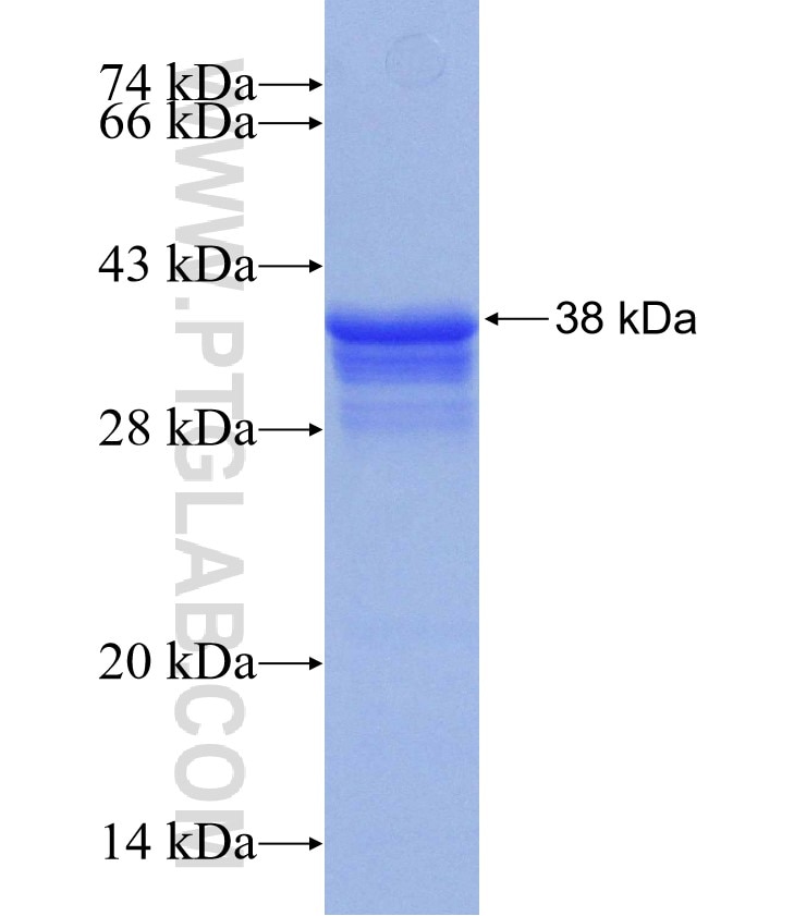 RPL5 fusion protein Ag30837 SDS-PAGE