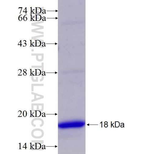 RPL5 fusion protein Ag7662 SDS-PAGE