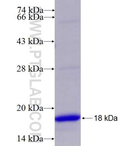 RPL5 fusion protein Ag7662 SDS-PAGE RPL5 fusion protein Ag7662 SDS-PAGE
