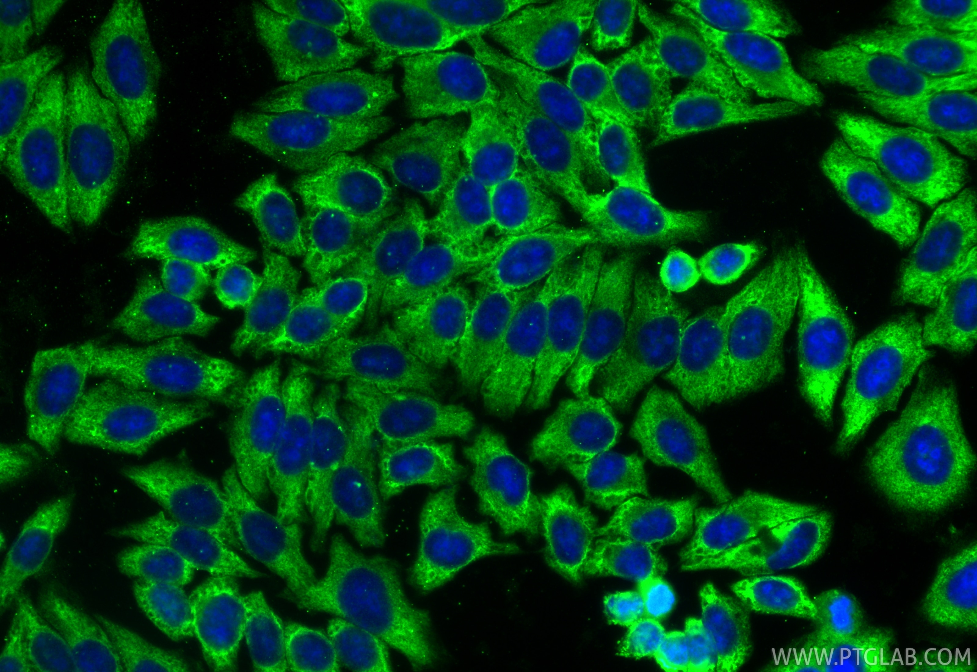 Immunofluorescence (IF) / fluorescent staining of HepG2 cells using RPL6 Polyclonal antibody (15387-1-AP)