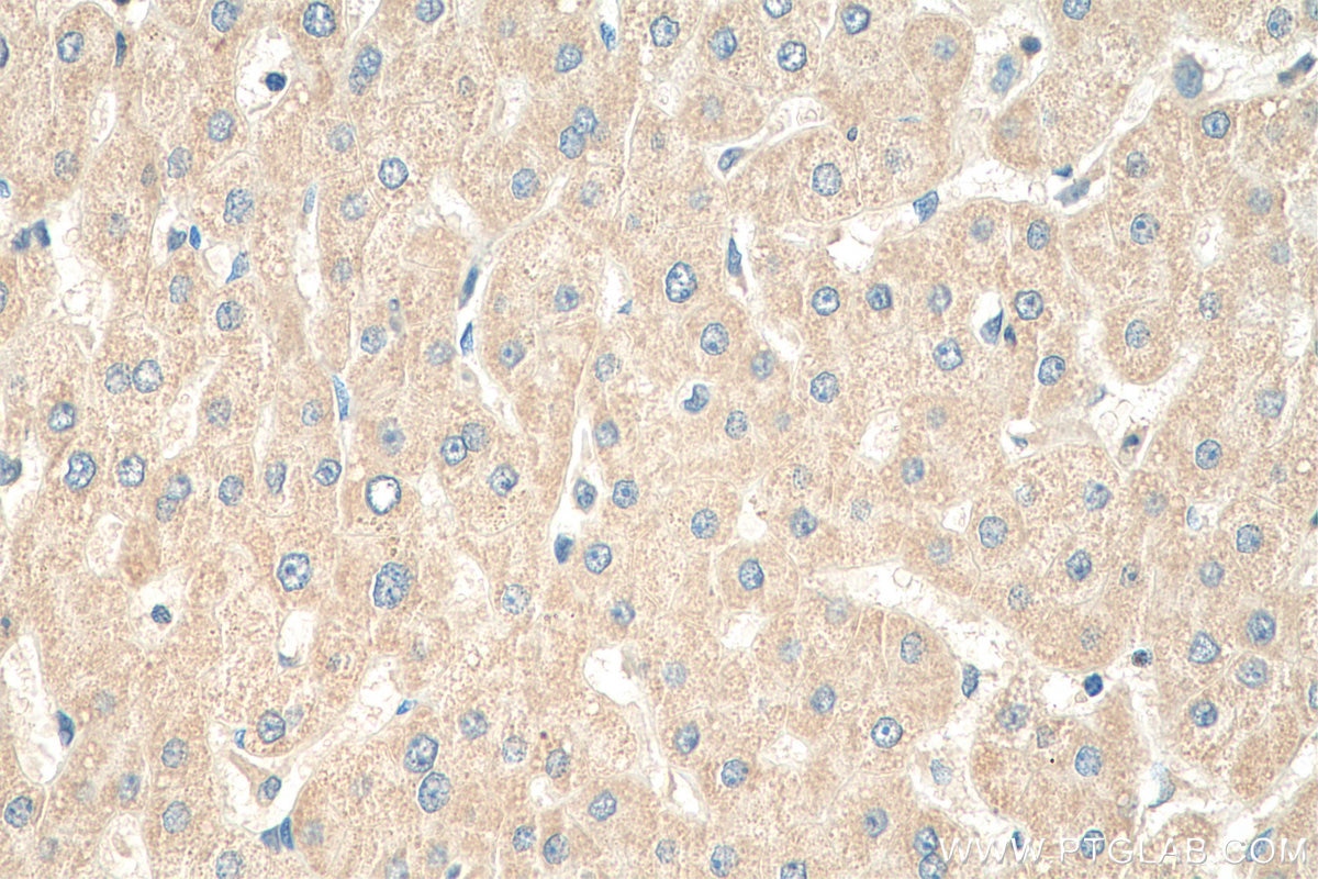 Immunohistochemistry (IHC) staining of human liver tissue using RPL6 Polyclonal antibody (15387-1-AP)