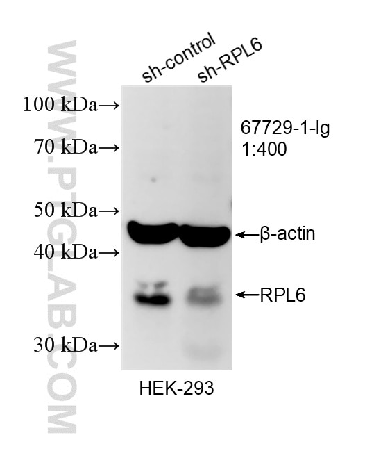 Western Blot (WB) analysis of HEK-293 cells using RPL6 Monoclonal antibody (67729-1-Ig)