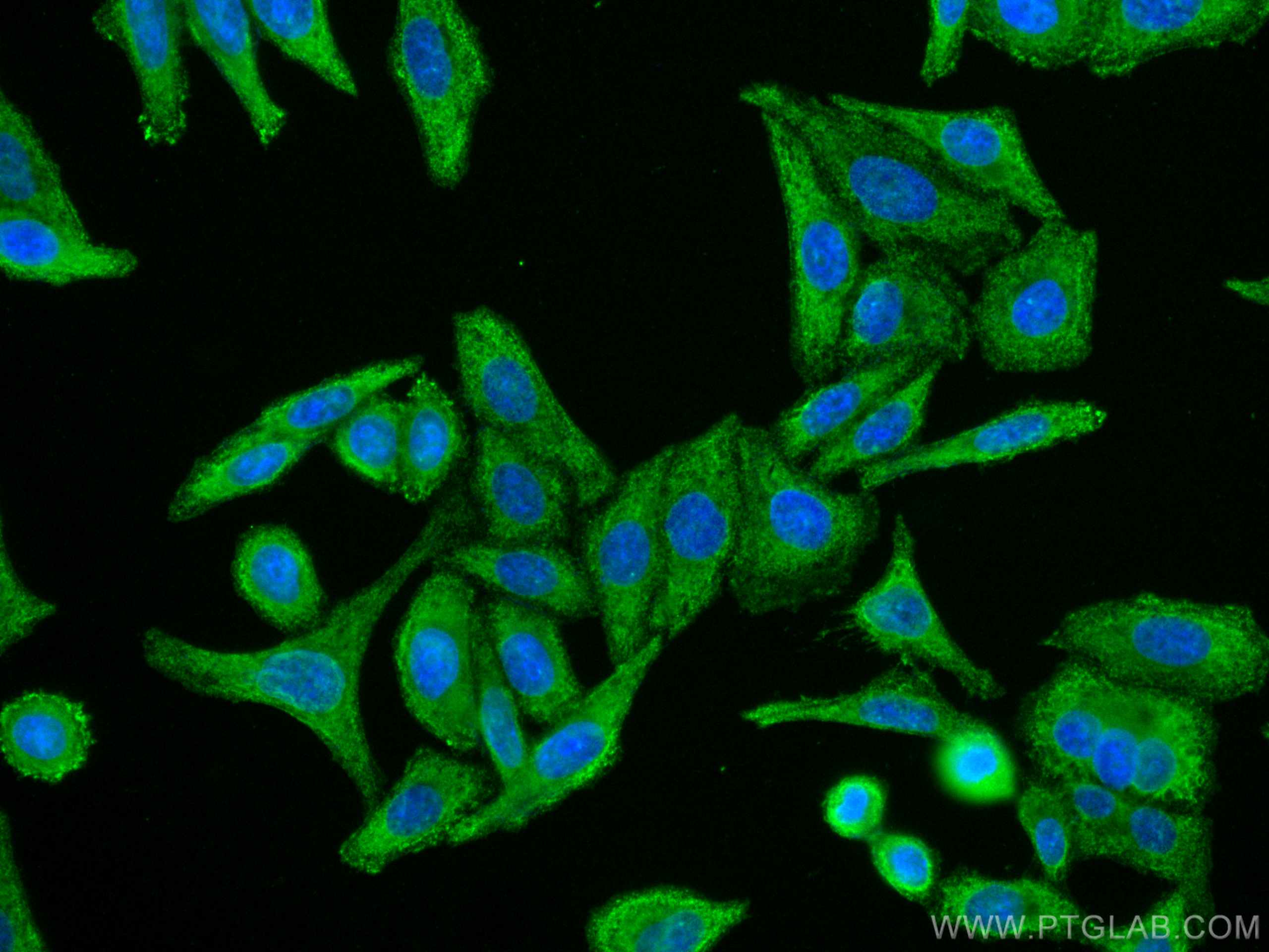 Immunofluorescence (IF) / fluorescent staining of HepG2 cells using CoraLite® Plus 488-conjugated RPL6 Monoclonal anti (CL488-67729)